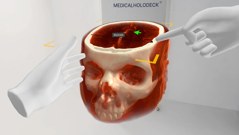 A spatial skull visualization with a pointer for explaining anatomy